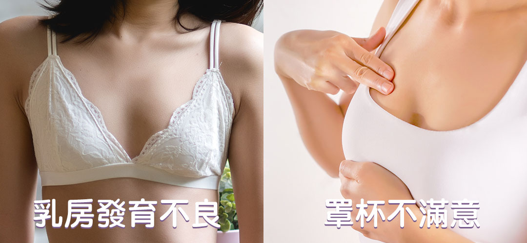 閨密女醫黃馨慧醫師複合式隆乳困擾點-01