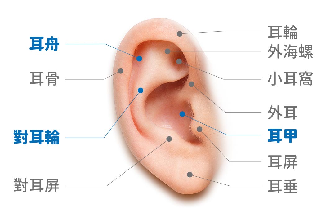 黃馨慧醫師招風耳手術