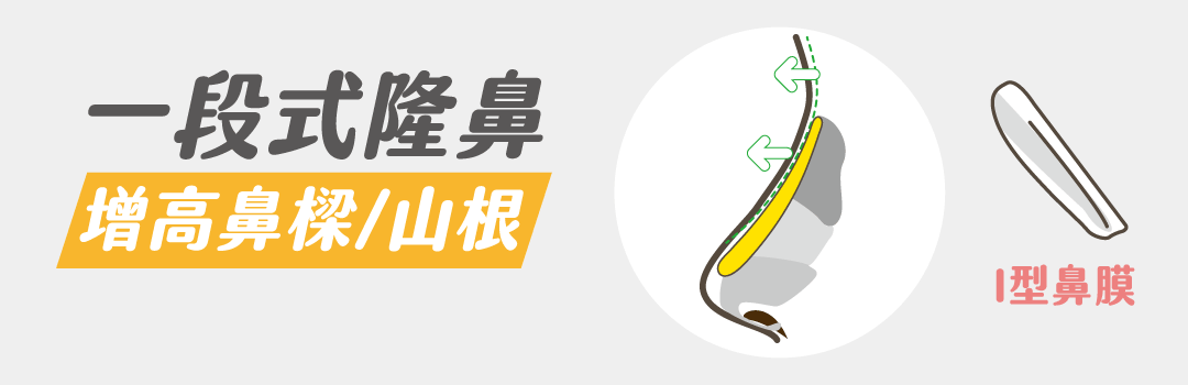 一段式隆鼻手術