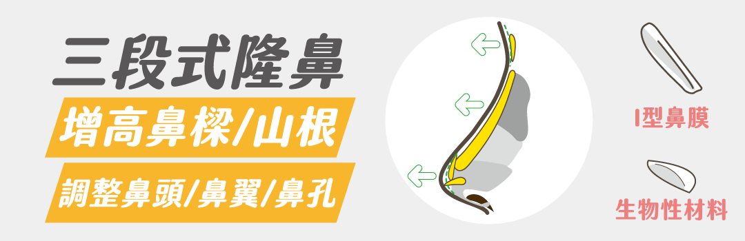 三段式隆鼻手術