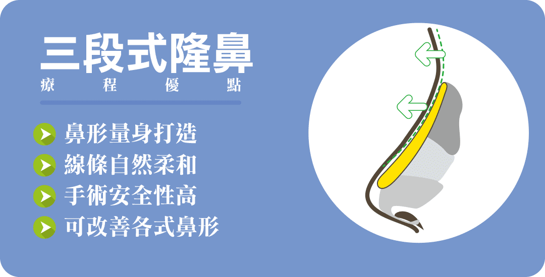 結構式隆鼻手術優點