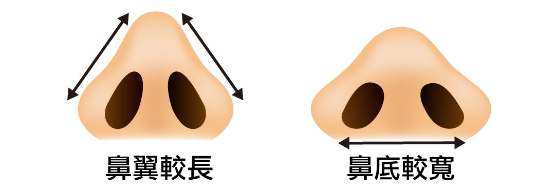 鼻孔大縮鼻翼之前的困擾-01