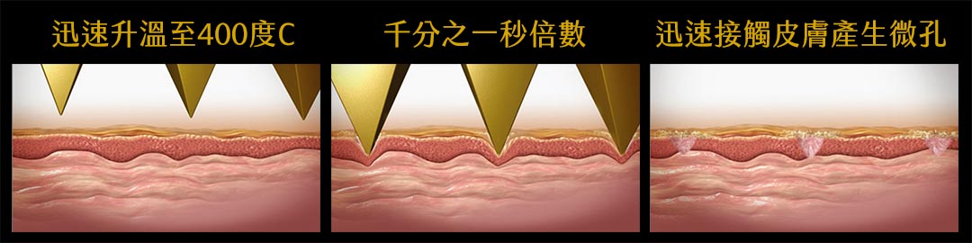 TMA創新金字塔鈦金矩陣作用原理