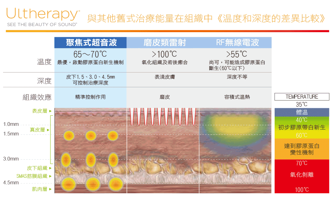 超音波拉提的精準治療