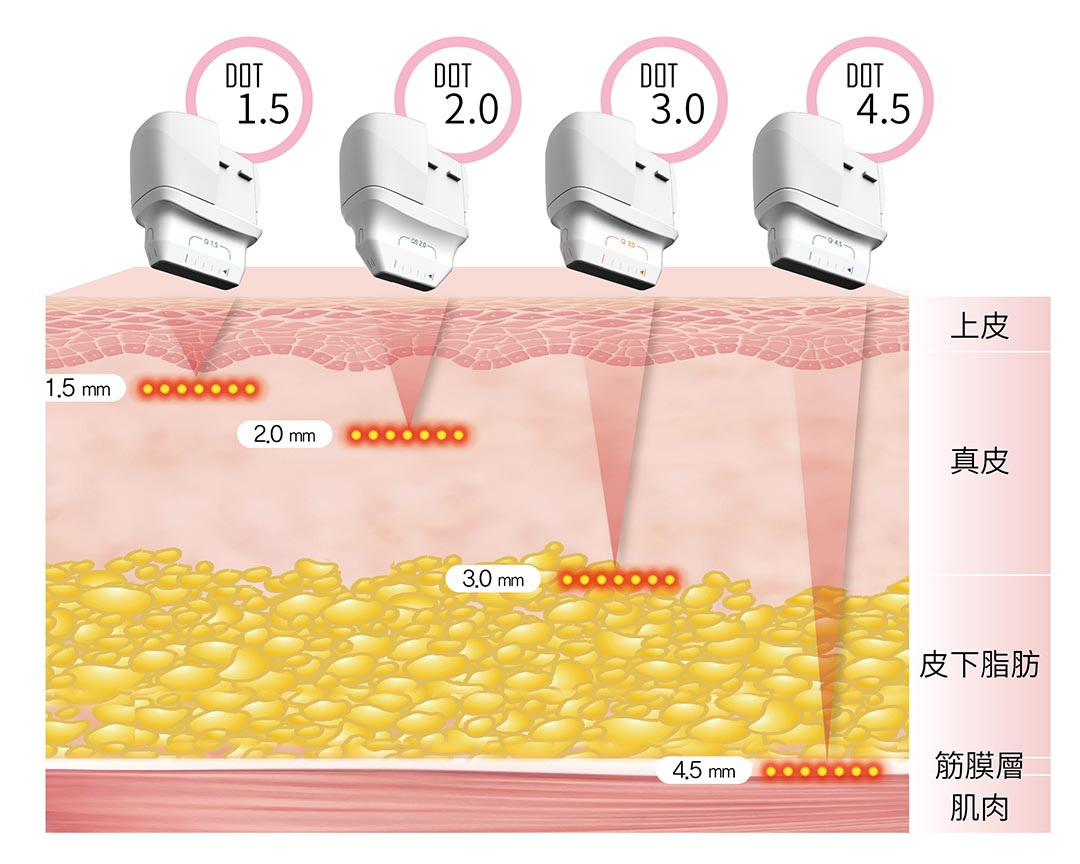 Q+音波拉提5款不同探頭