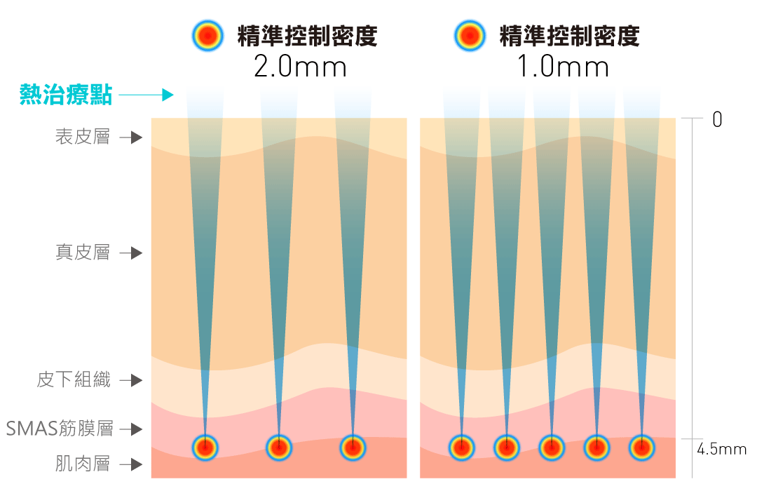 Q+音波拉提5款不同探頭